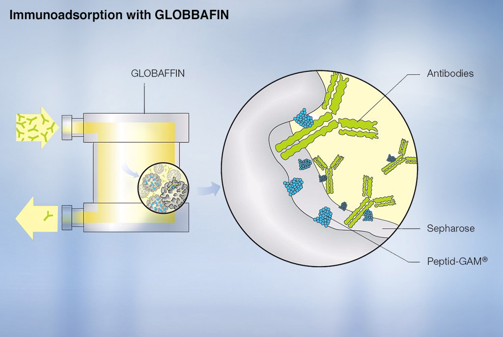 Immunoadsorbimento con GLOBAFFIN Immunoadsorbimento con GLOBAFFIN