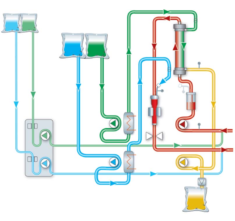 Schema Ci-Ca post-CVVHDF